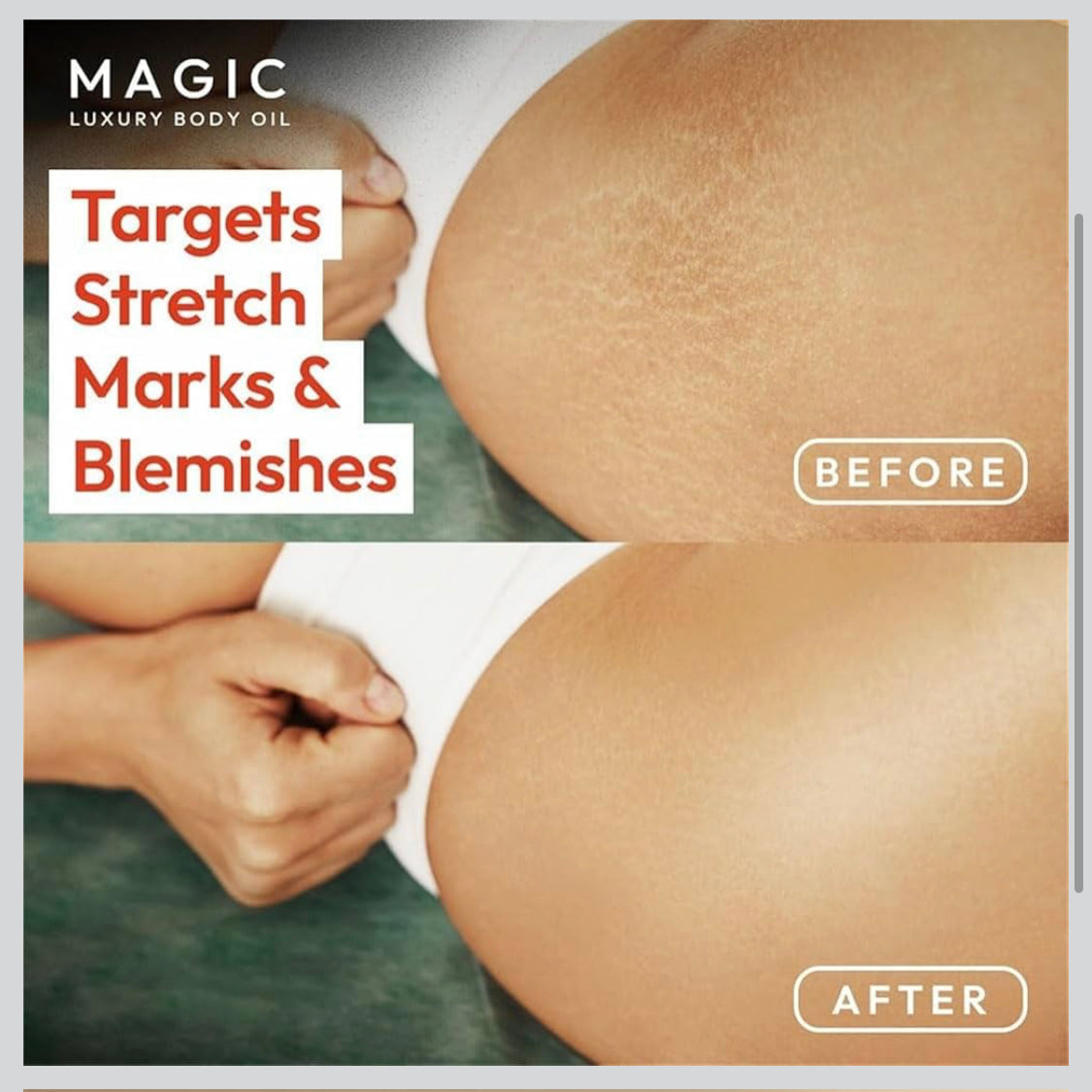 Magic Body Oil - 100 ml, repulpe, raffermit, raffermit et hydrate la peau