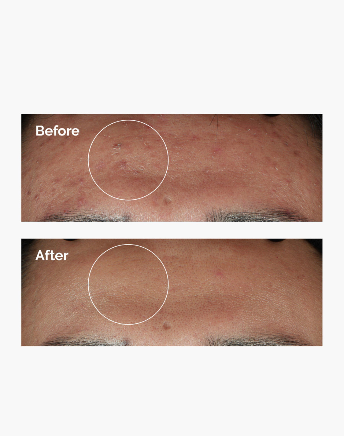 The ordinary- Niacinamide10% + Zinc Serum visage.